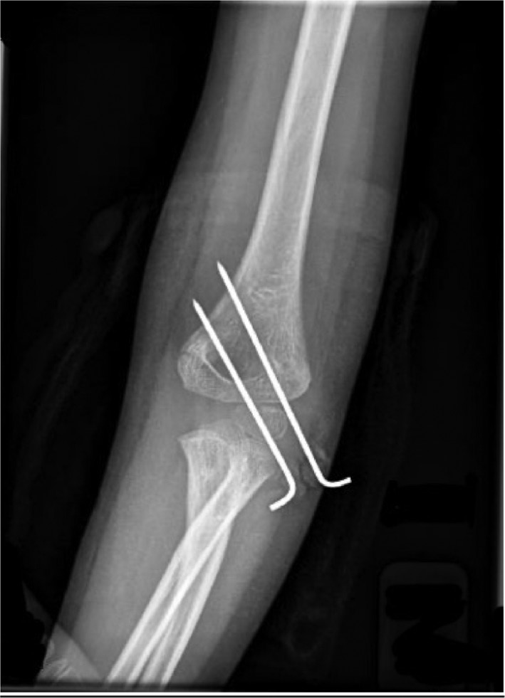 jposna20220039_fig3.jpg