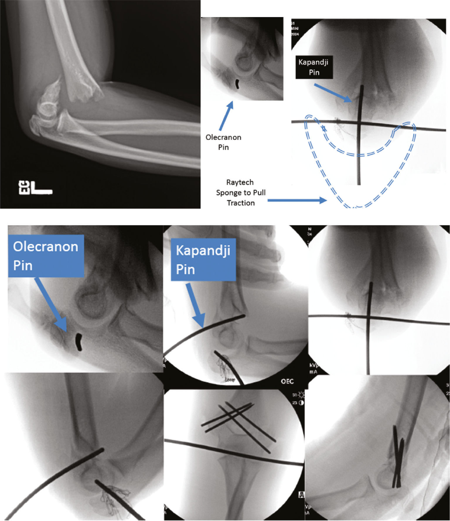 jposna20220039_fig5.jpg
