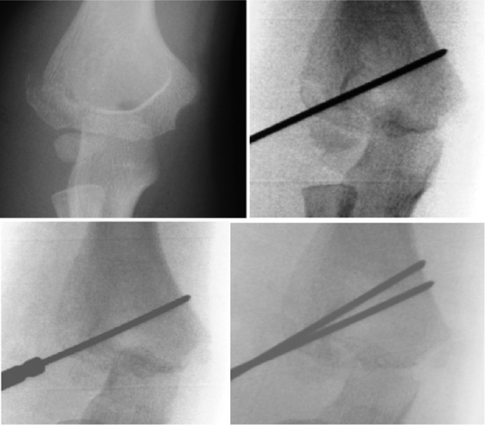 jposna20220039_fig8.jpg