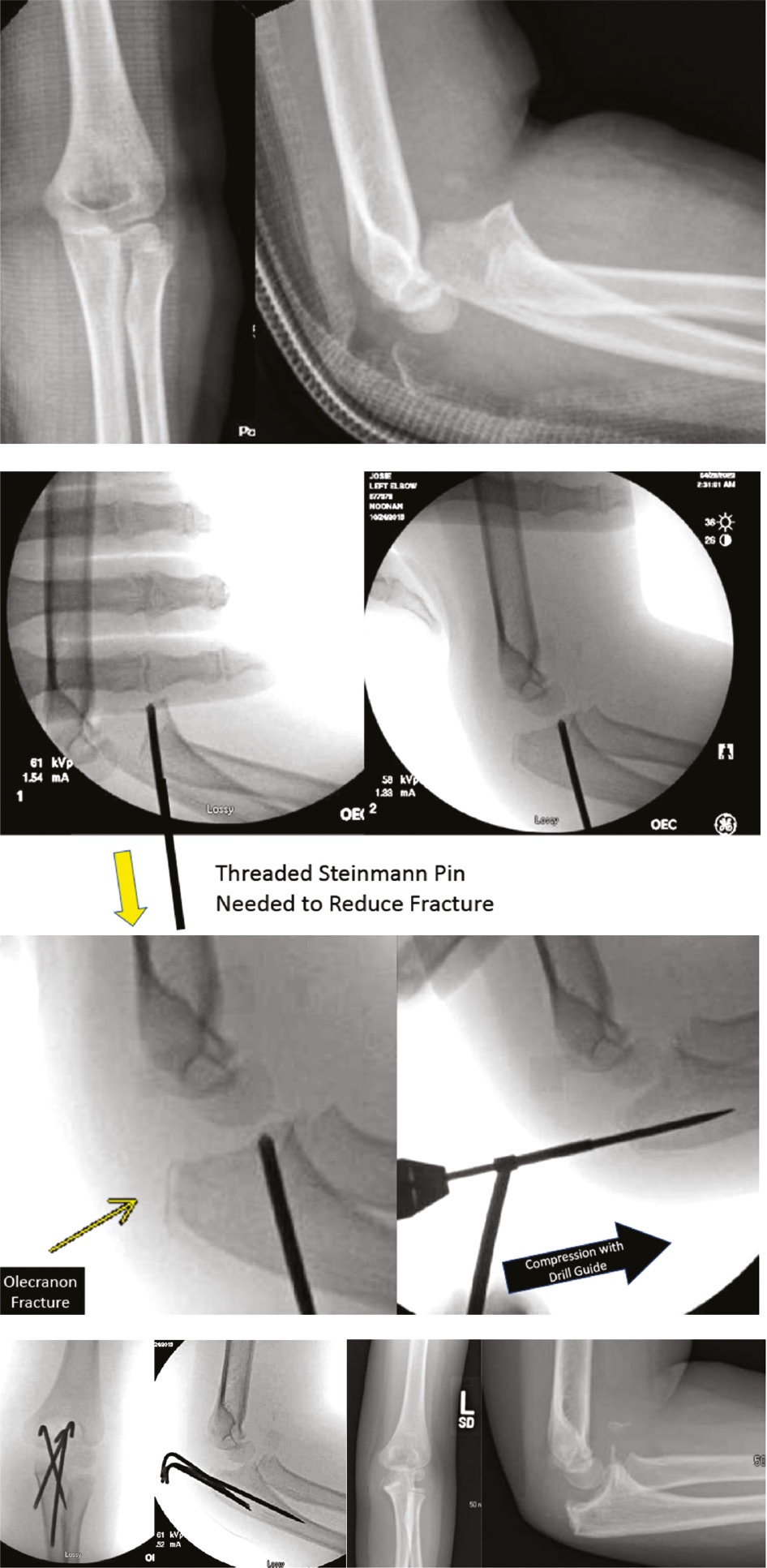 jposna20220039_fig10.jpg