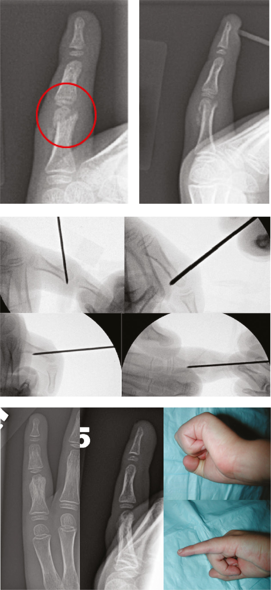 jposna20220039_fig14.jpg