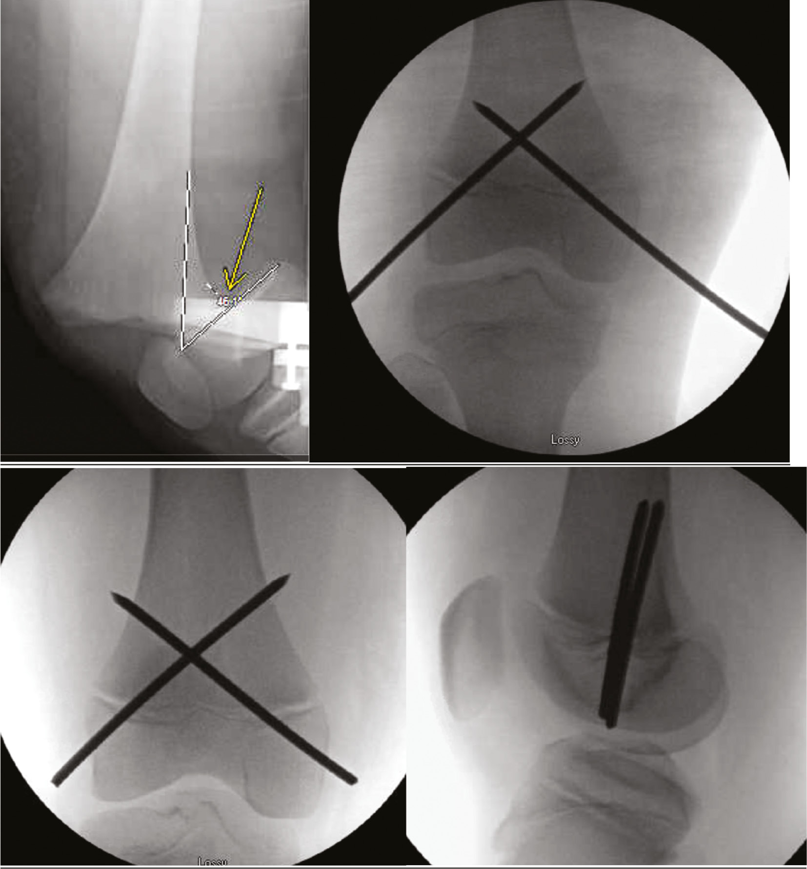 jposna20220039_fig15.jpg