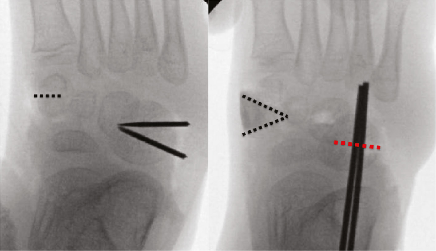 jposna20220039_fig18.jpg