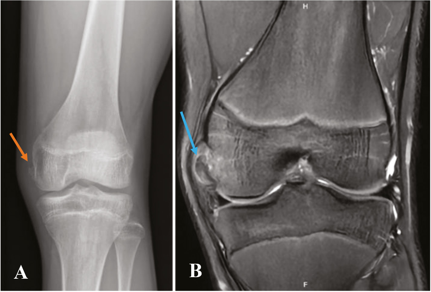 jposna2023757_fig3.jpg