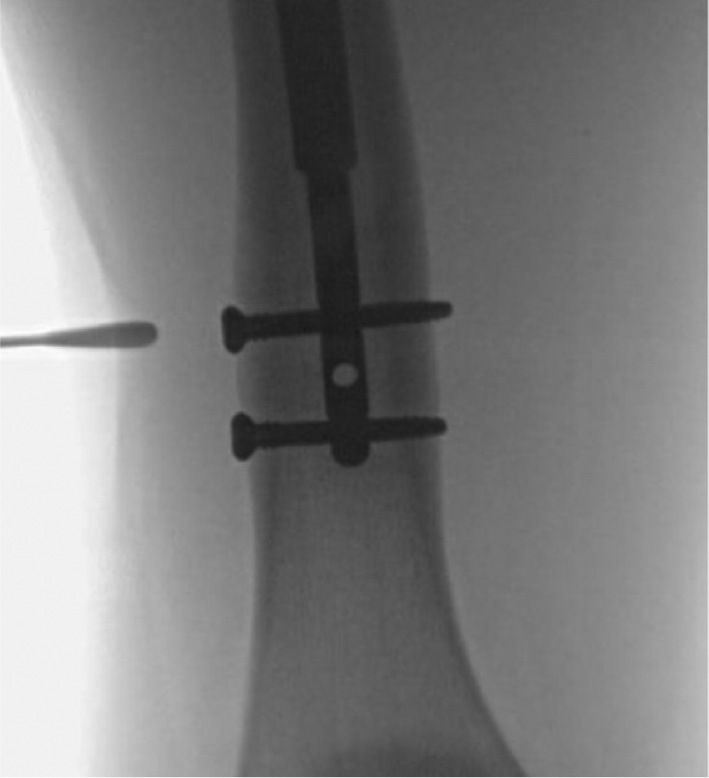 jposna20220031_fig4.jpg