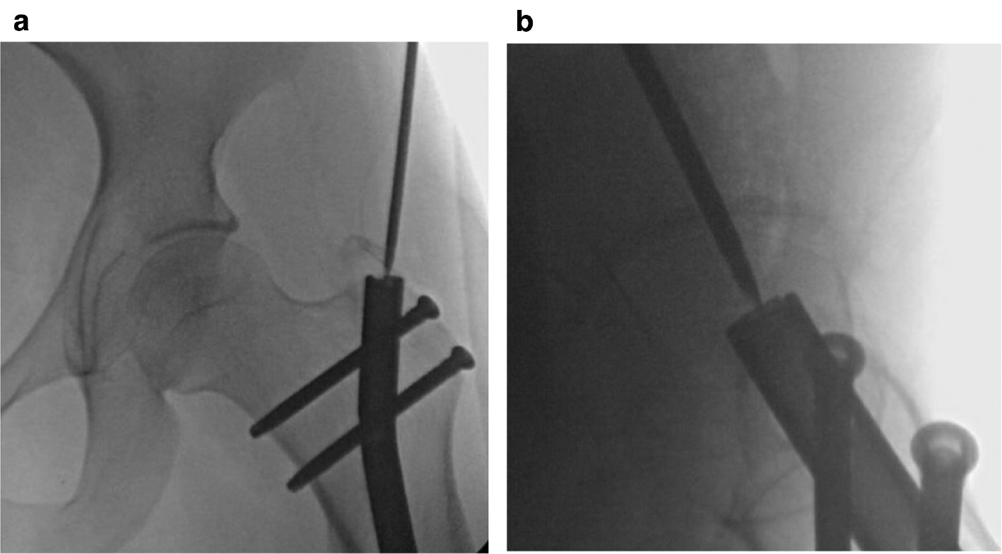 jposna20220031_fig7.jpg