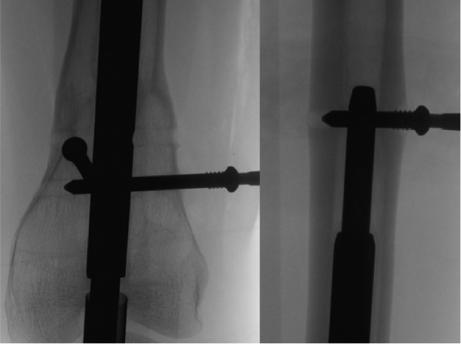 jposna20220031_fig22.jpg