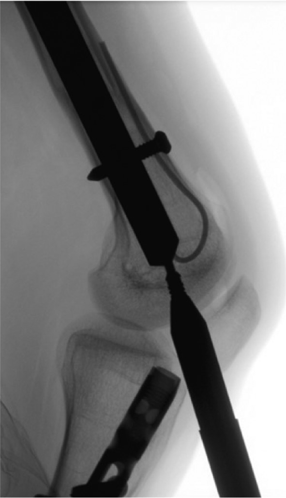 jposna20220031_fig31.jpg