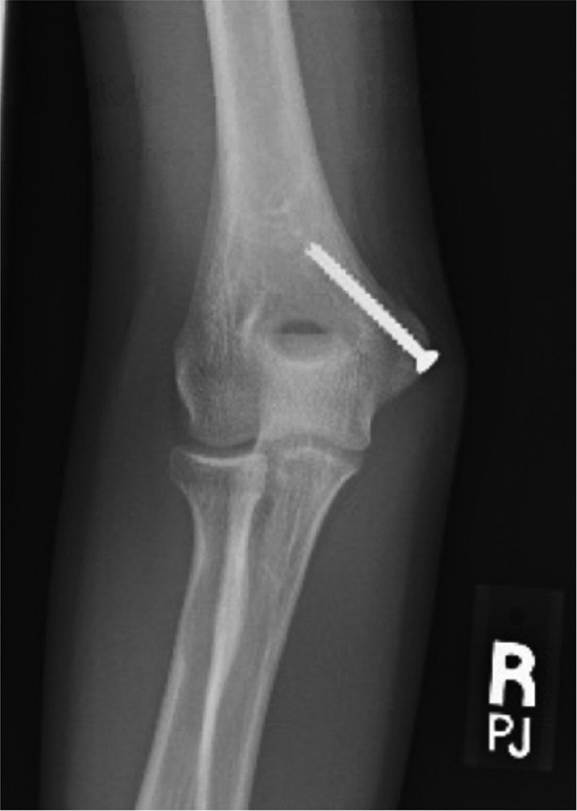 jposna20220081_fig7.jpg