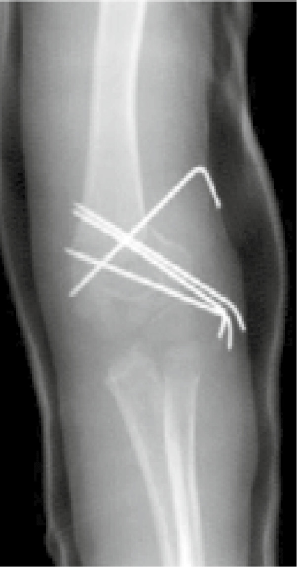 jposna2022566_fig2.jpg