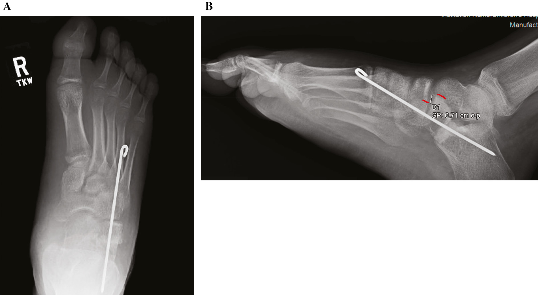 jposna2022567_fig3.jpg