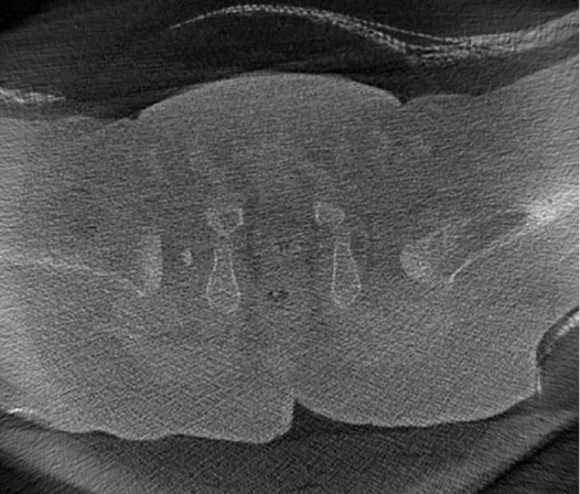 jposna2023650_fig4.jpg