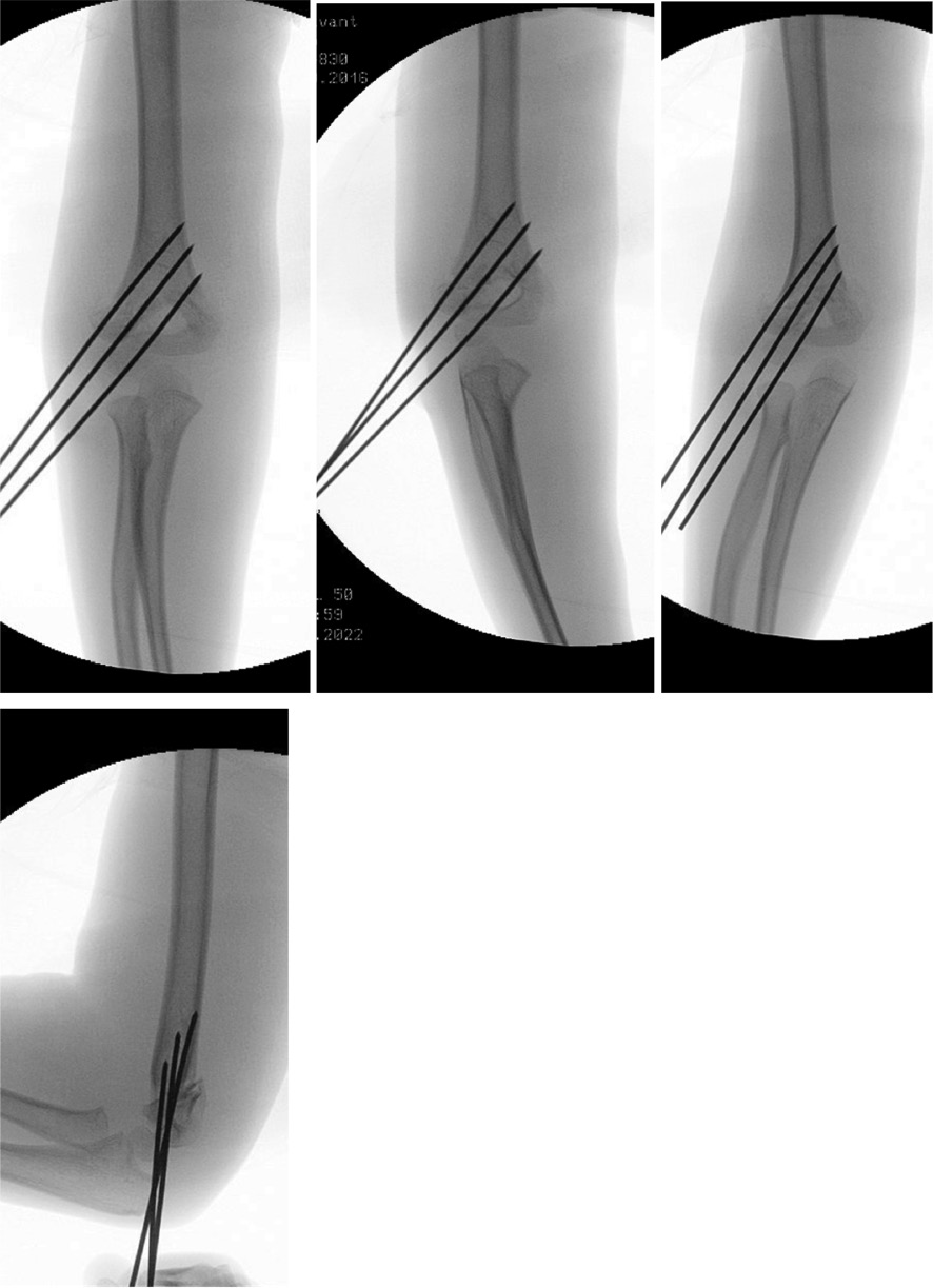 jposna2023665_fig2.jpg