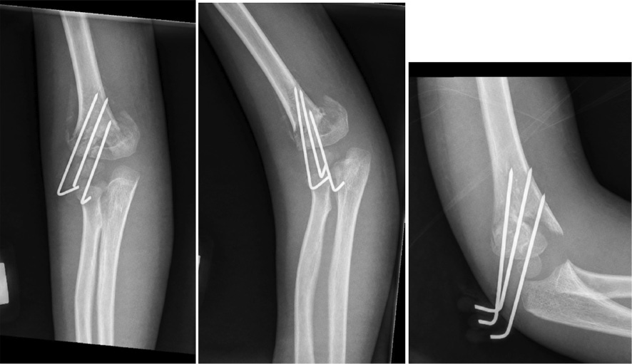 jposna2023665_fig4.jpg