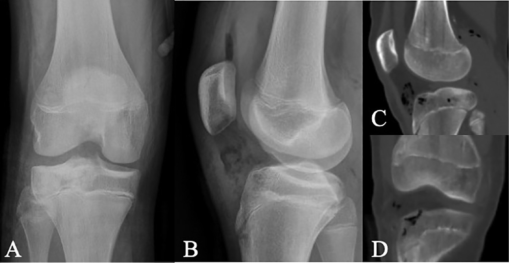 jposna2023683_fig5.jpg