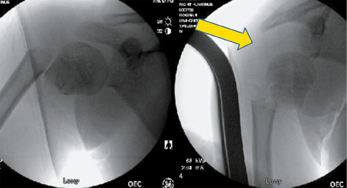 jposna2023703_fig5.jpg