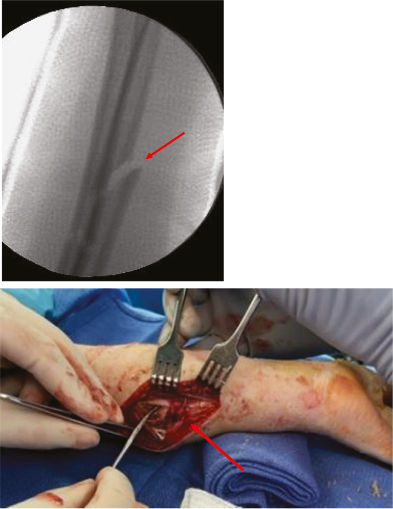 jposna2023708_fig6.jpg