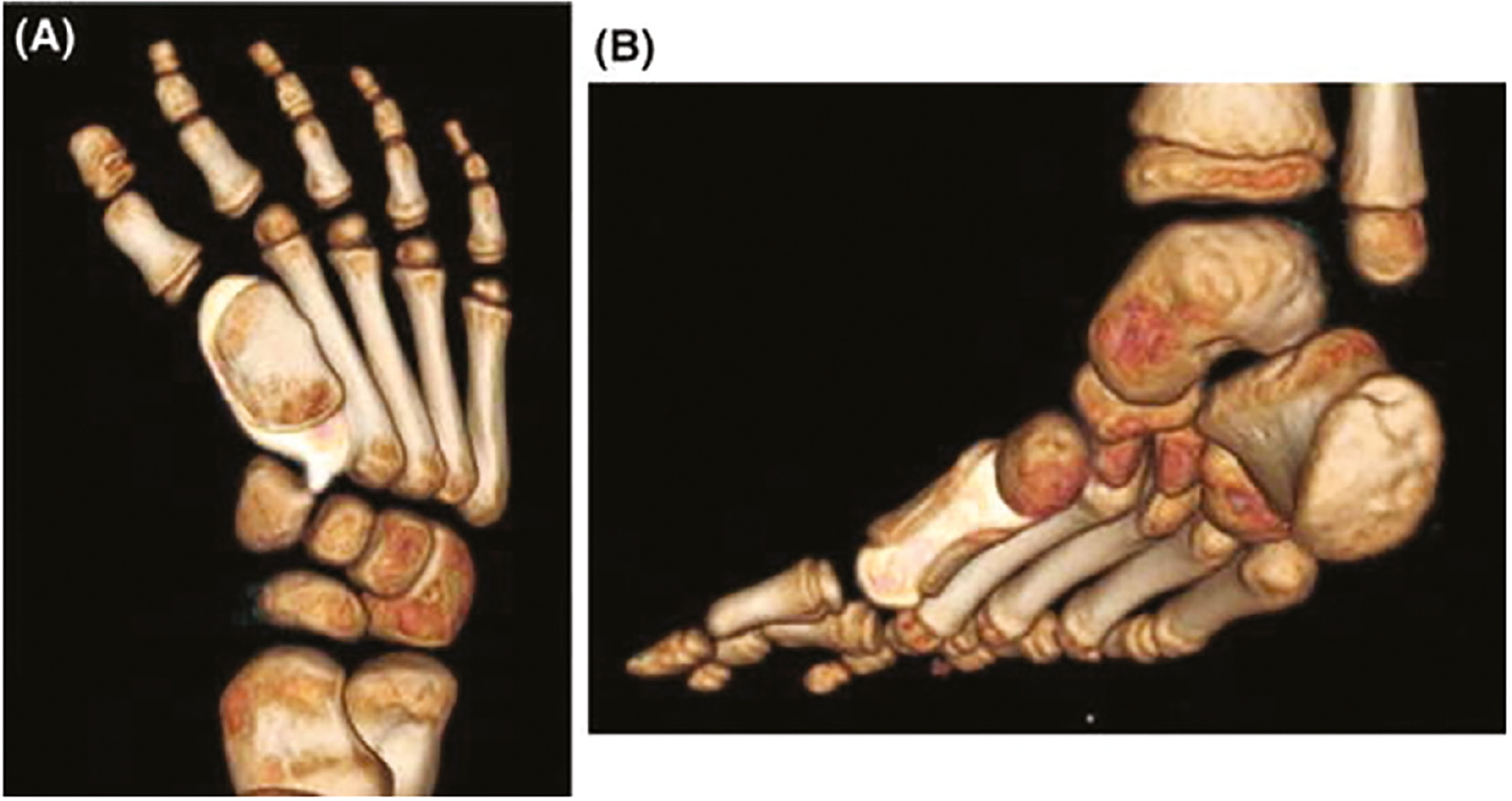 jposna2023773_fig4.jpg